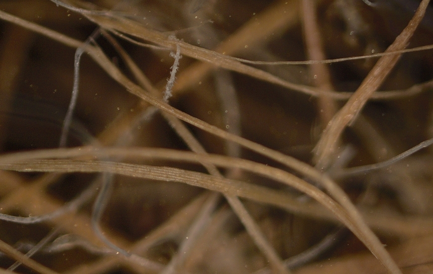 Microscopic images of Posidonia